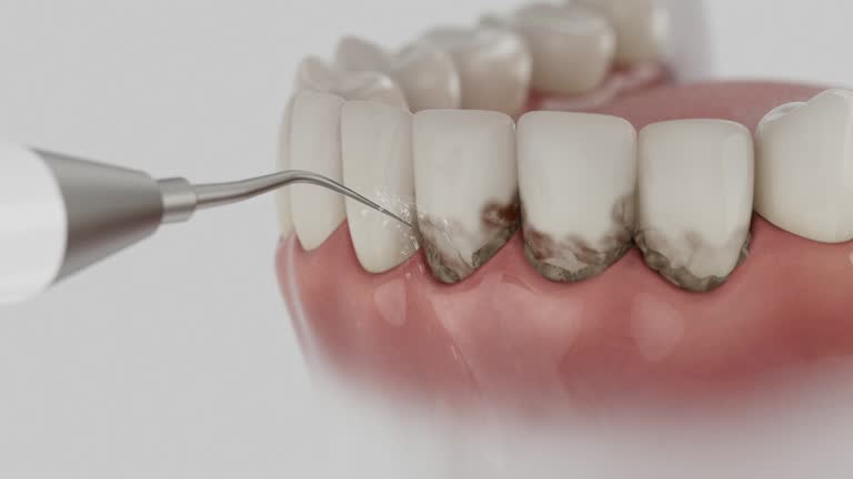 Trusted Tooth Extraction service in Gun Barrel City, TX - Dentist Open Now